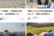 曬背養(yǎng)生火了 醫(yī)生提醒過度曬背可能造成曬傷